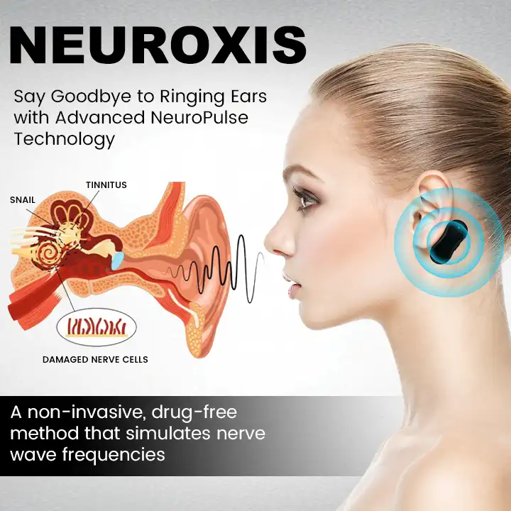 Tinnitus Relief Device Serenity - Image 7