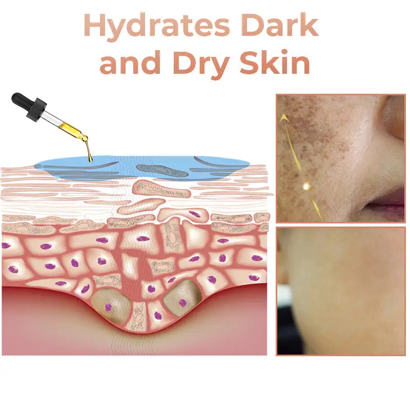 Fast Dark Spot Remover - Image 4
