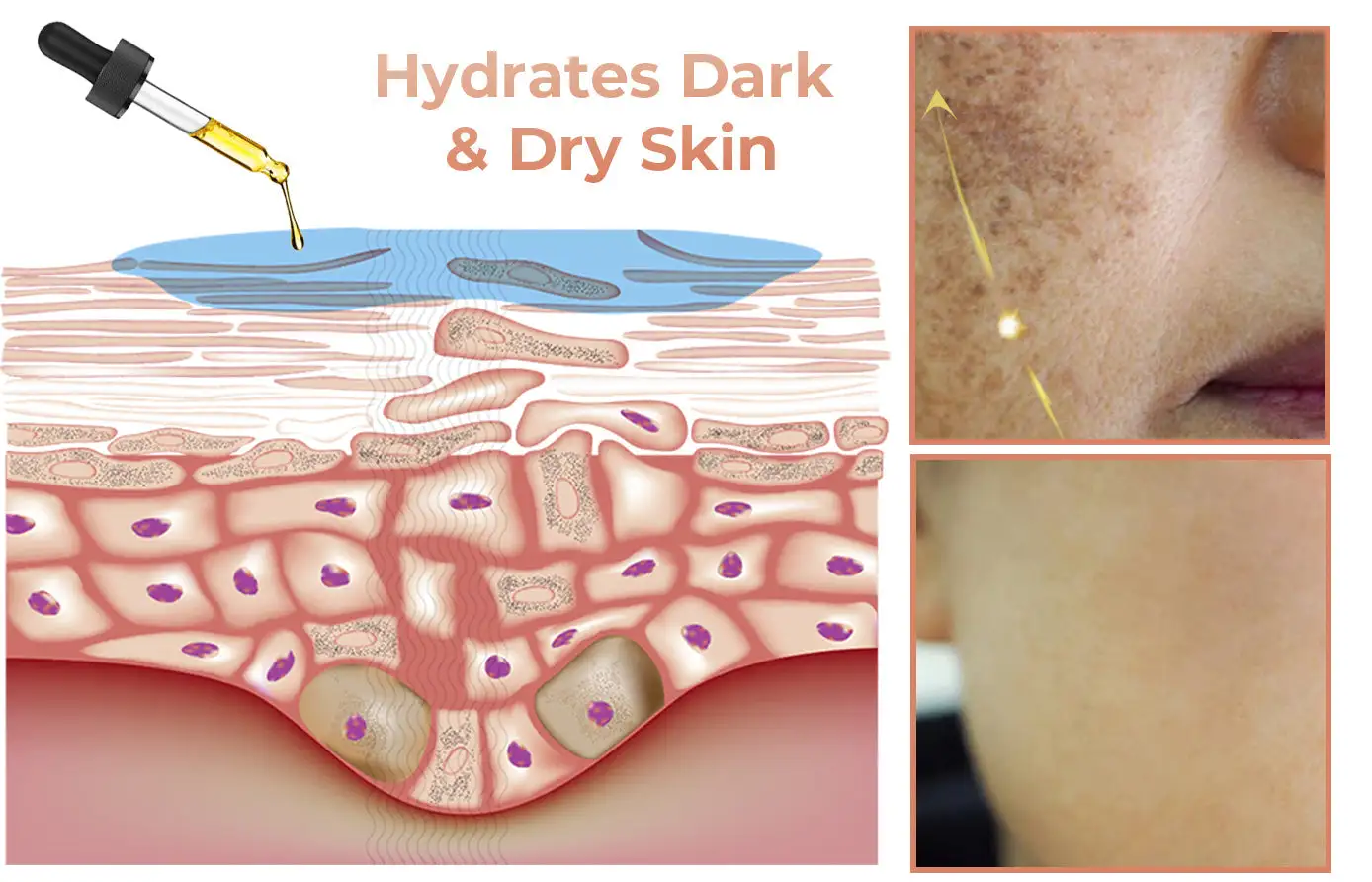 Fast Dark Spot Remover - Image 5