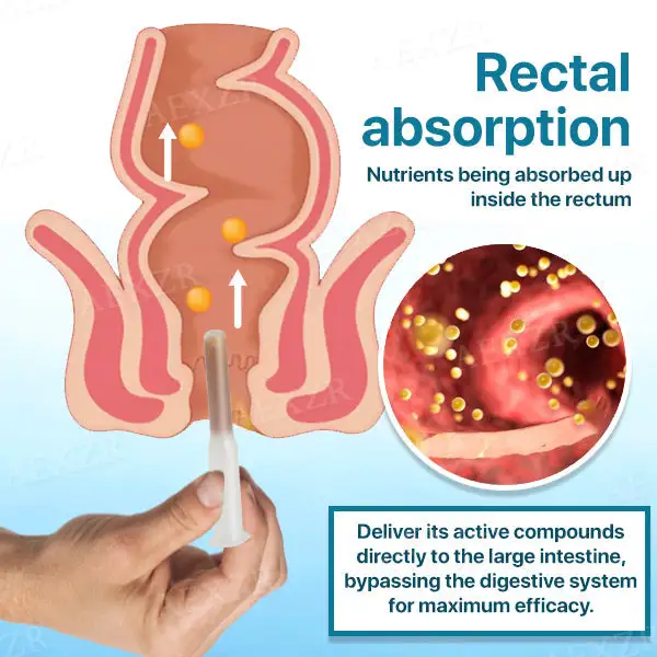 Colon and Polyps Removal Cure - Image 3