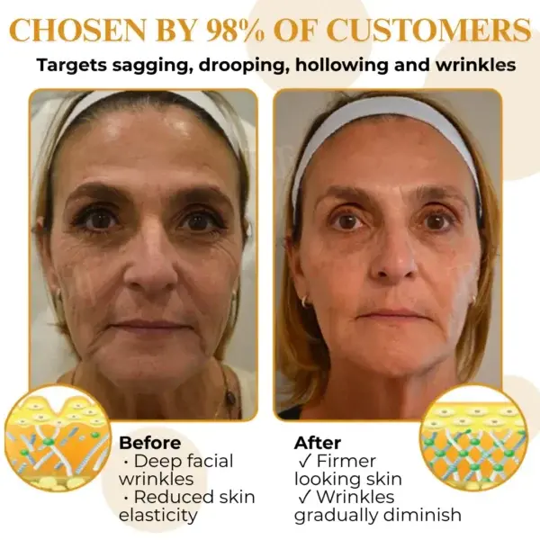 Letybo Bee Venom Wrinkle Removal Cream - Image 4