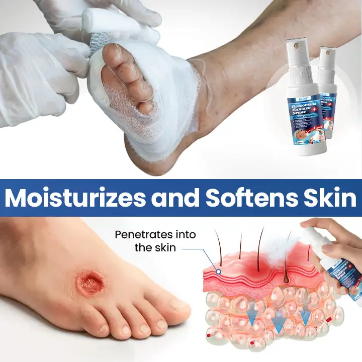 GlucoDerm Barrier Spray - Image 6