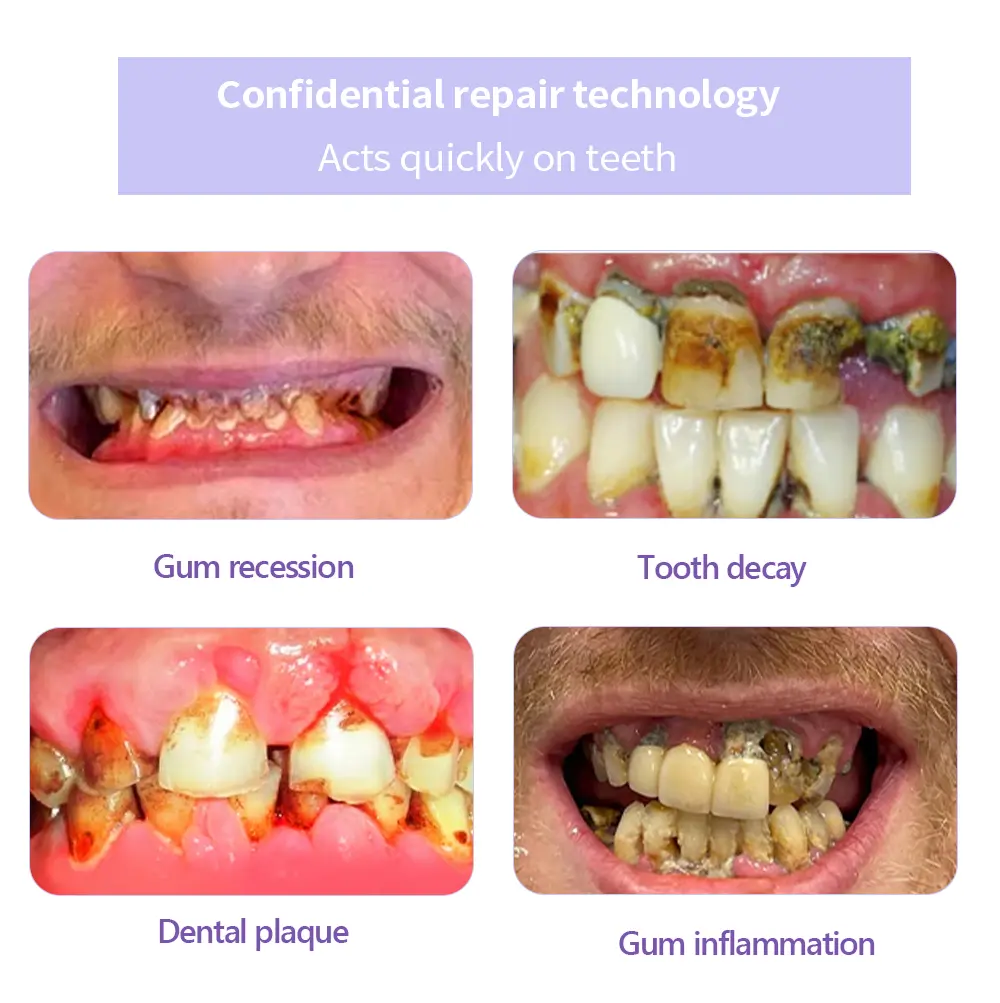 Winter Sale Teeth Restoration Mineral Powder - Image 8