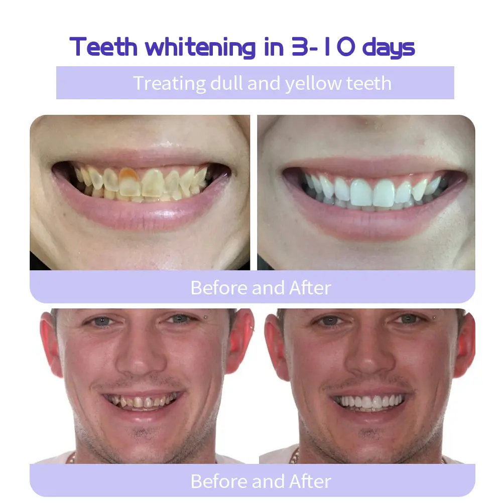 Winter Sale Teeth Restoration Mineral Powder - Image 9