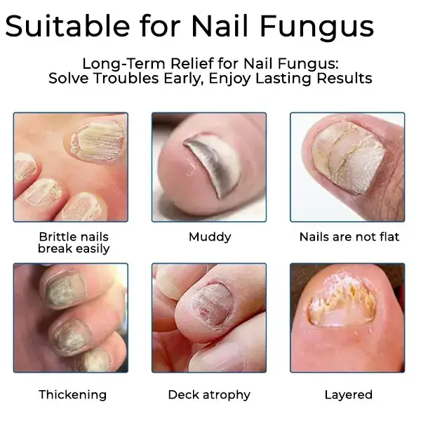 Nail Fungus Care Patches - Image 6