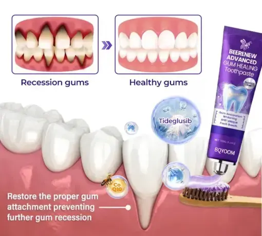 Tongue Coating Cleaning Gel - Image 3
