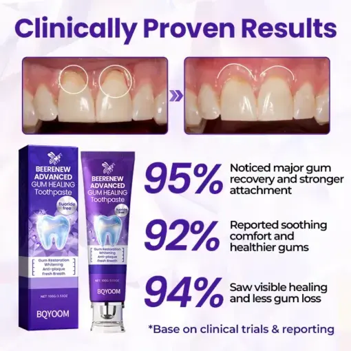 Tongue Coating Cleaning Gel - Image 4