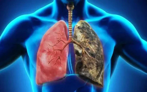 BREATHE-RIGHT DENDROBIUM & MULLEIN EXTRACT: POWERFUL LUNG SUPPORT CLEANSE & RESPIRATORY - Image 3