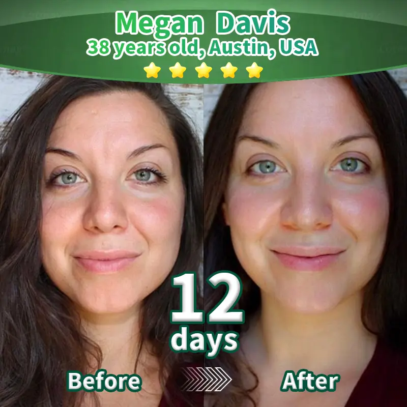 Stem Cell–Derived EGF & Copper Peptide Activating Serum - Image 5