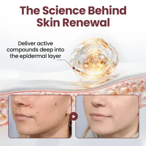 KeraErase RICEDUAL-ACTION RENEWAL CREAM - Image 4