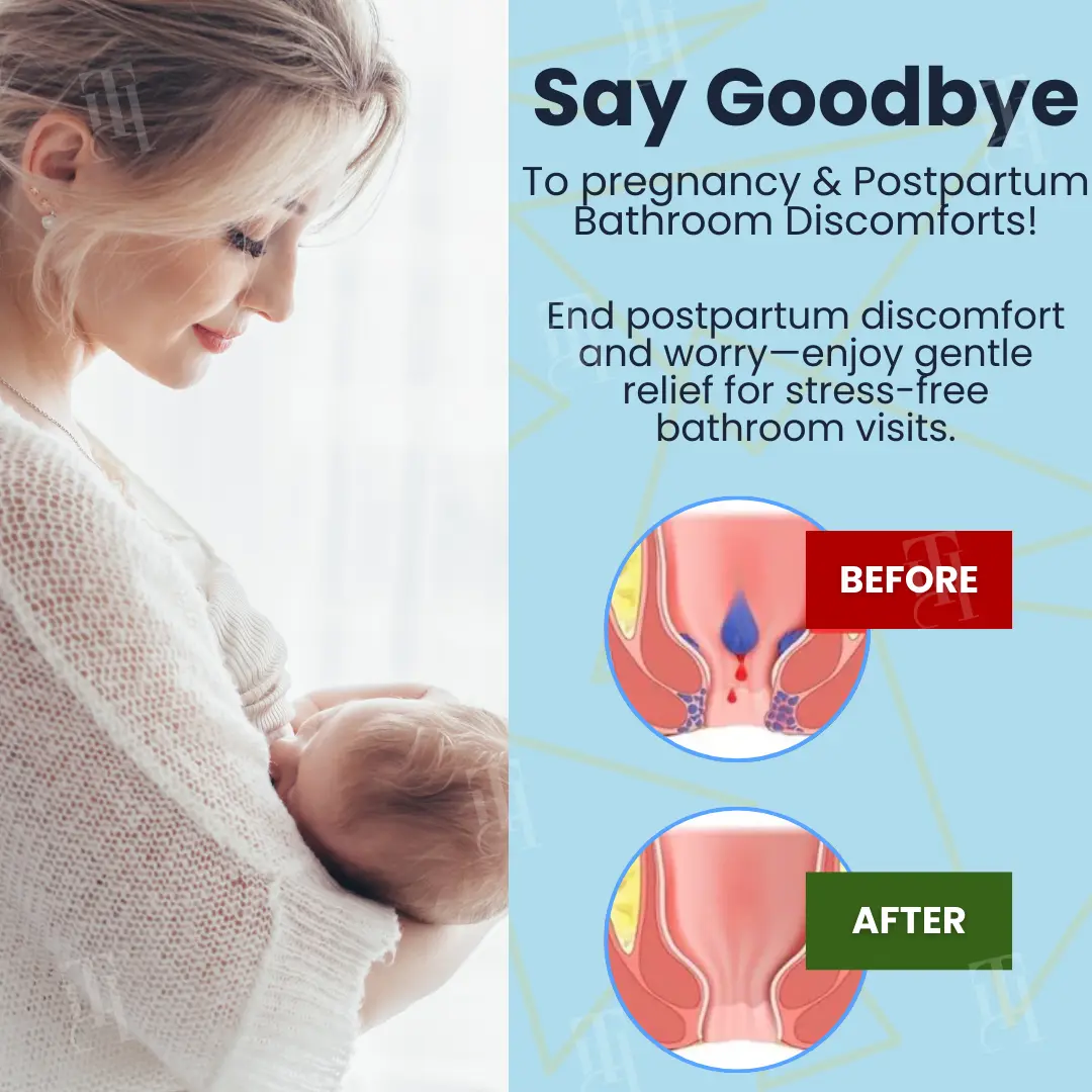 Herbal Hemorrhoid Treatment Anal Spray + Wipes - Image 2