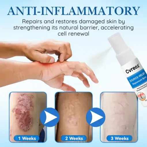 Source-Relief Magnesium Spray - Image 4