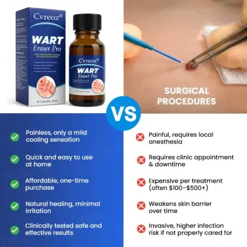Wart Eraser Pro - Image 5
