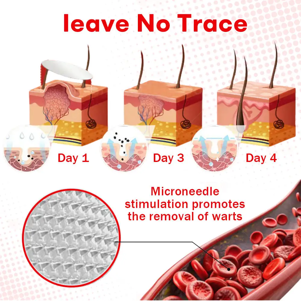 MicroNeedle BotanicSkin Tag Removal Patch - Image 7