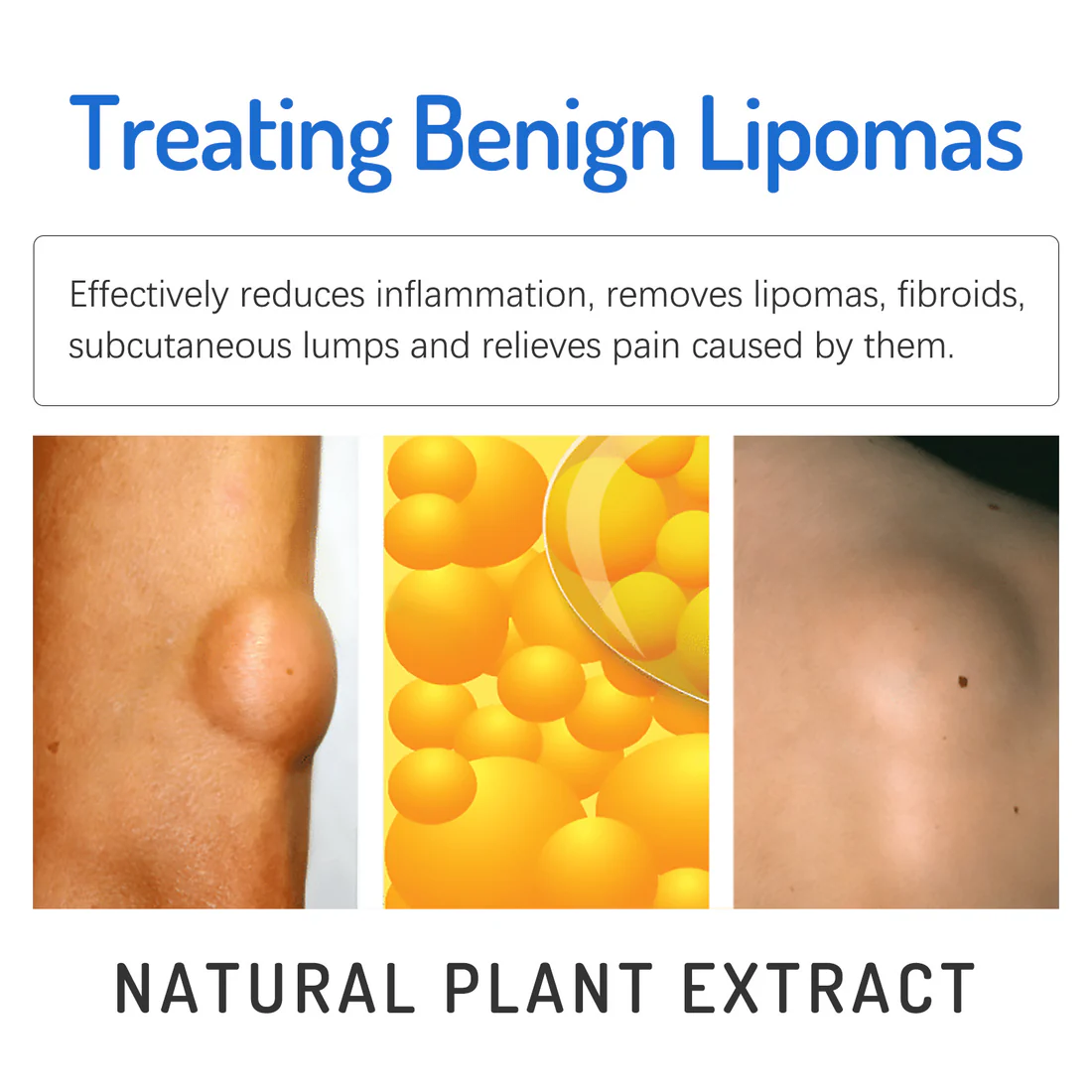 Bee Venom Lipoma Removal Cream - Image 6