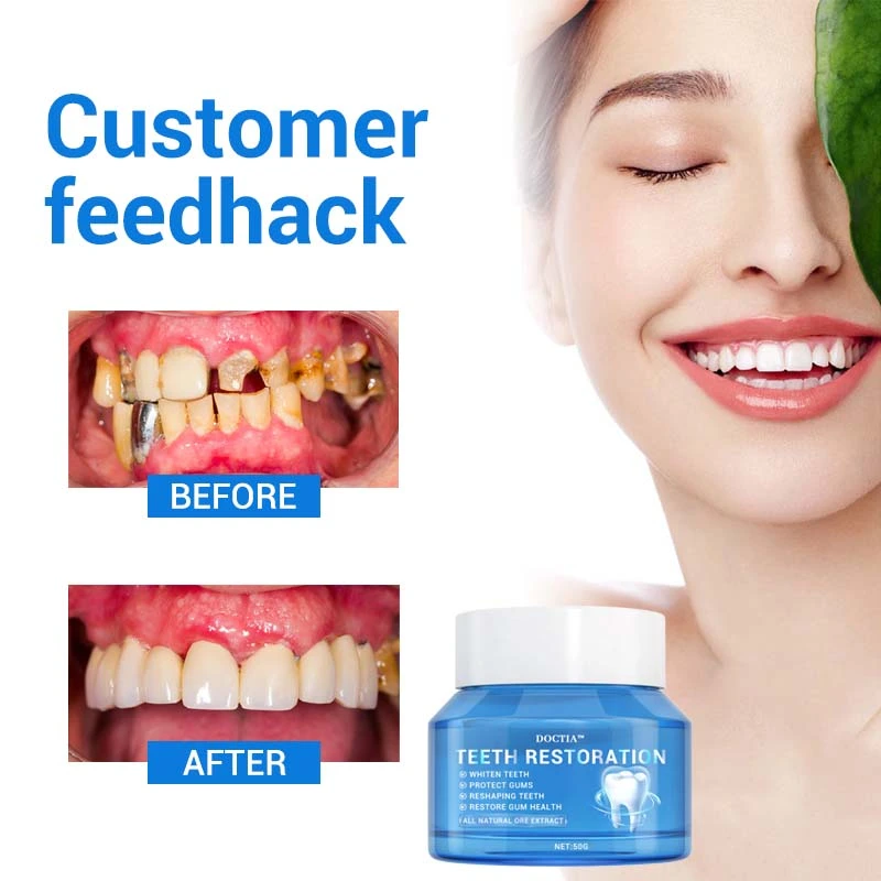 Teeth Restoration Mineral Powder - Image 14