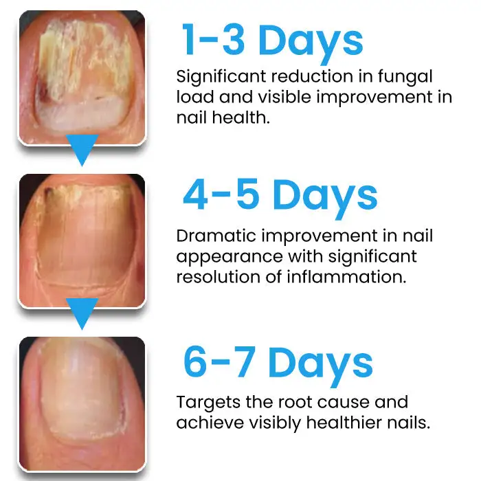 NanoFix Nail Repair Pen - Image 6