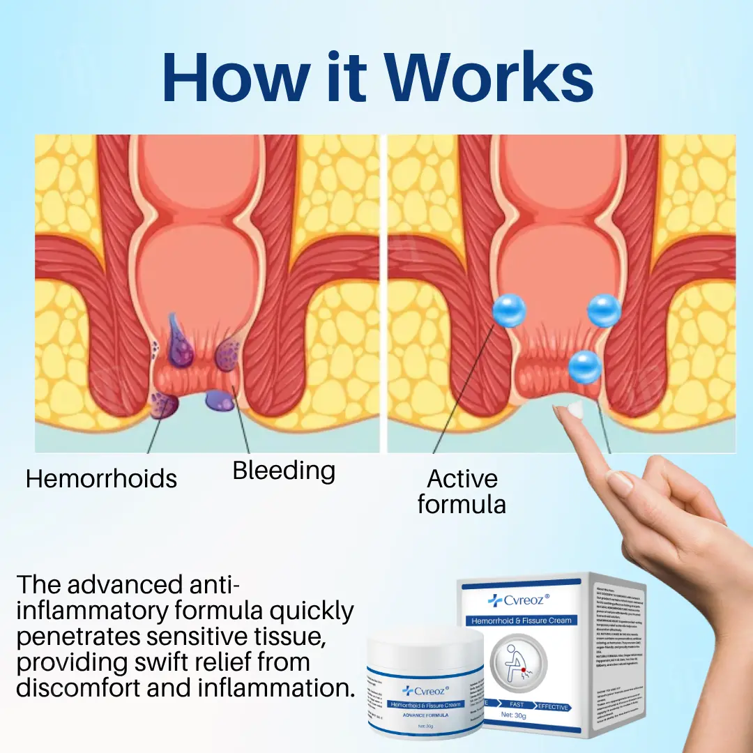 Hemorrhoid & Fissure Cream - Image 6