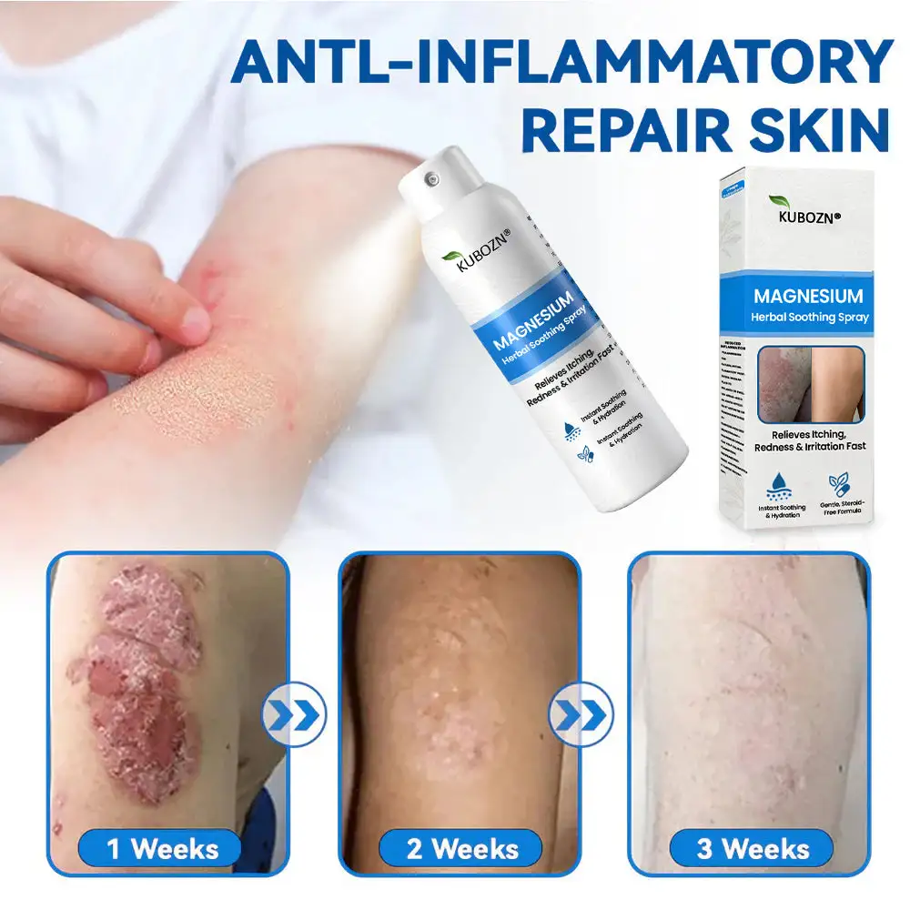 Magnesium Herbal Psoriasis Spray - Image 2