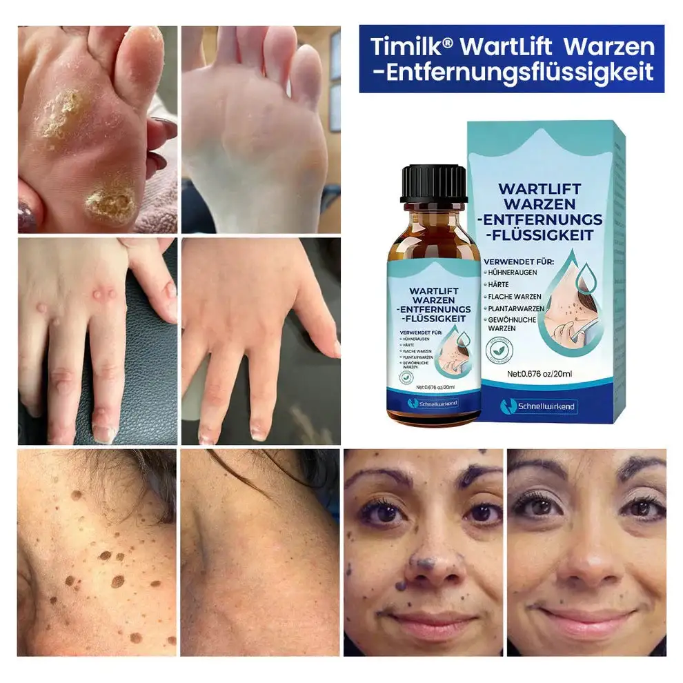 WartLift Wart Removal Fluid - Image 2
