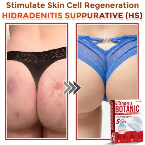 Removal Patch - Image 9