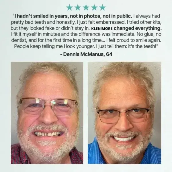 Custom-Fit Fully Functional Dentures - Image 12