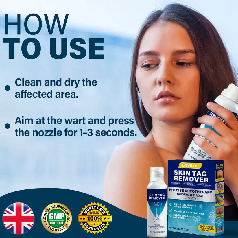 Cryo Treatment Spray Effortlessly remove skin tags and warts-no pain - Image 3