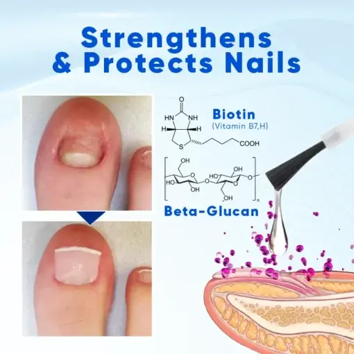 OnyxoGuard Nail Growth and Repair Serum - Image 4