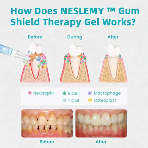 Gum Shield Therapy Gel - Image 4