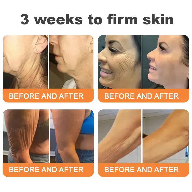 Instant FirmLift Temporary EYE Tightener - Image 2