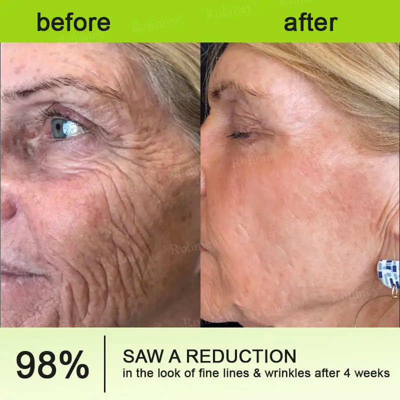 Botox & Vita-A Retinol Shot Wrinkle-Lift Tightening cream - Image 12