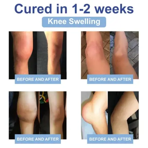 Magnesium Pain Relief & Bone Healing Cream - Image 3