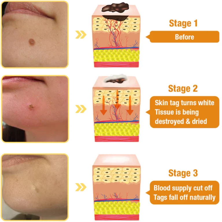 Tag Recede Bee Venom Treatment Spray - Image 5