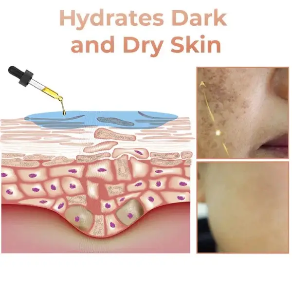 Fast Dark Spot Remover - Image 4