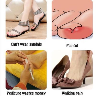 Glue Free Toenail Patch - Image 3