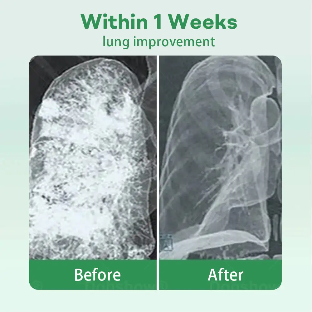 Herbal Lung Cleansing Inhaier - Image 2