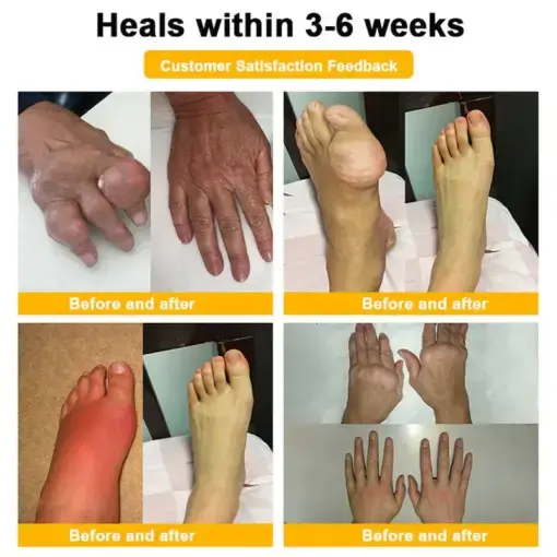 BEE VENOM LITHOSPERMUM Pain-Relief Bone Healing Cream - Image 13