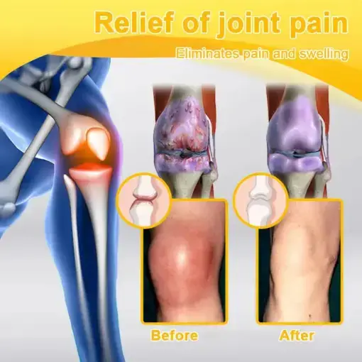 Bee Venom Joint Repair Cream - Image 21