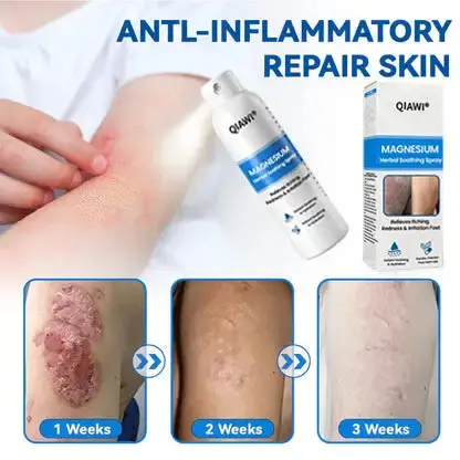 QIAWI Magnesium Herbal Psoriasis Spray - Image 2