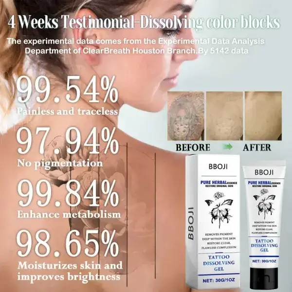 Tattoo Removal Cream - Fast Painless & Scar-Free Tattoo Erasure - Image 3