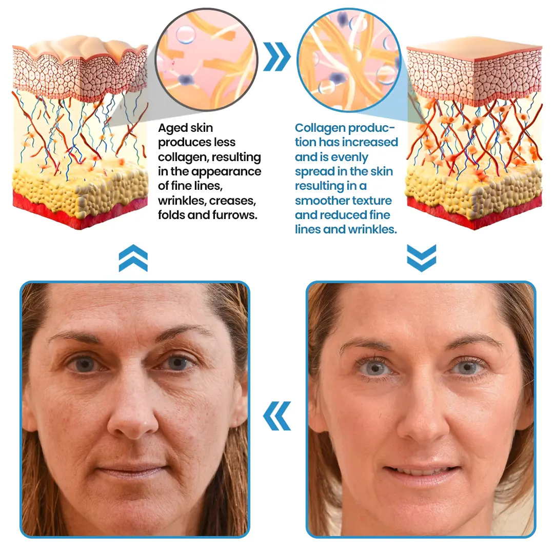 Collagen Peptide Serum - Image 4