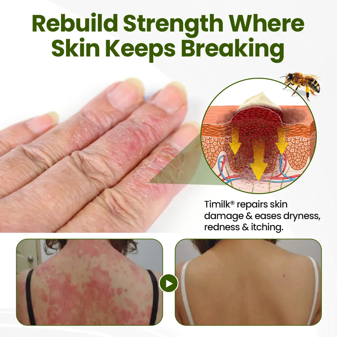 BeePeptide RootSoft DualRelief Cream - Image 4