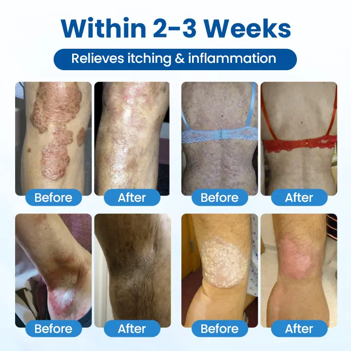 Magnesium Herbal Treatment Spray - Image 6