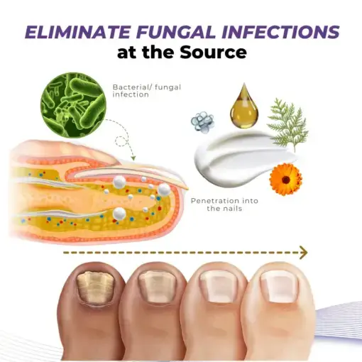 MycoOut Natural Nail Fungus Solution - Image 6