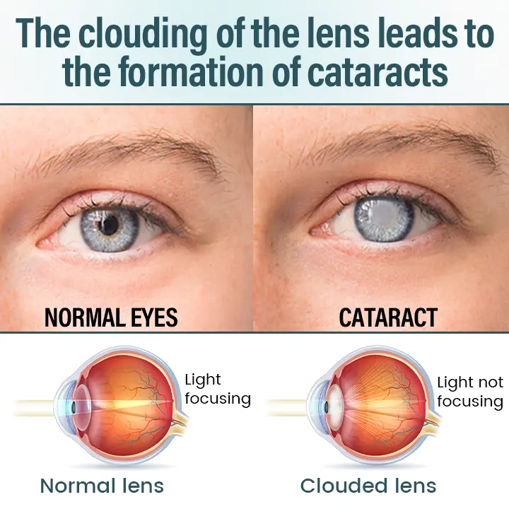 OptiFusion Nano Eye Drops Serum - Image 5