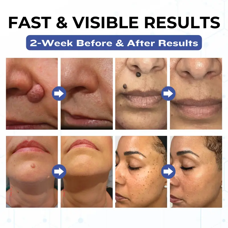 VanishPro Skin Spot Removal Cream - Image 2