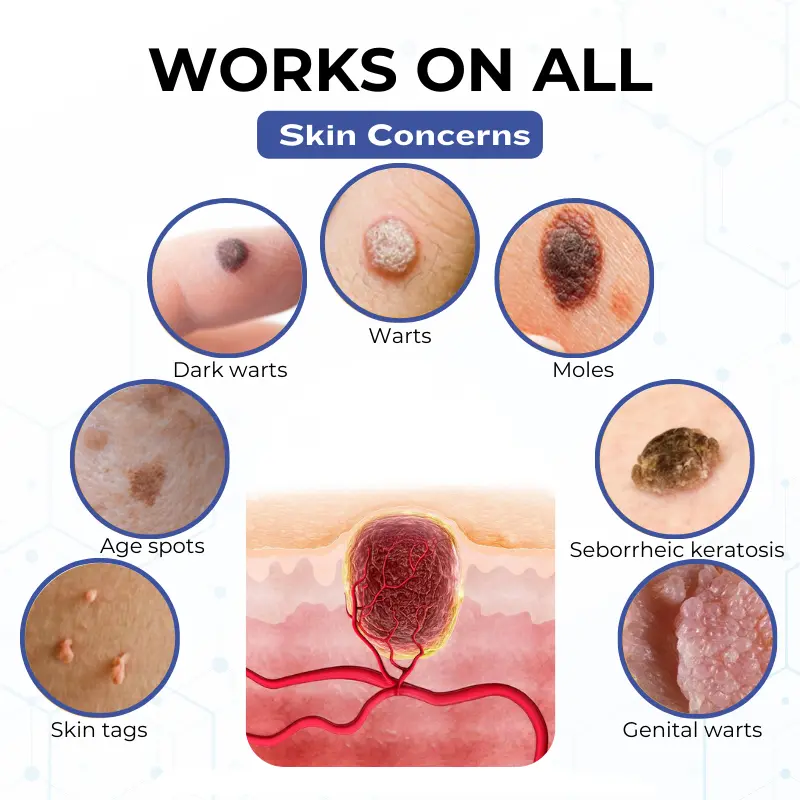 VanishPro Skin Spot Removal Cream - Image 7