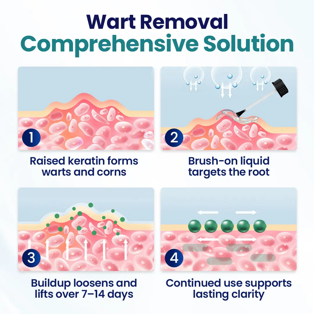 WartLift Corn Removal Liquid - Image 4
