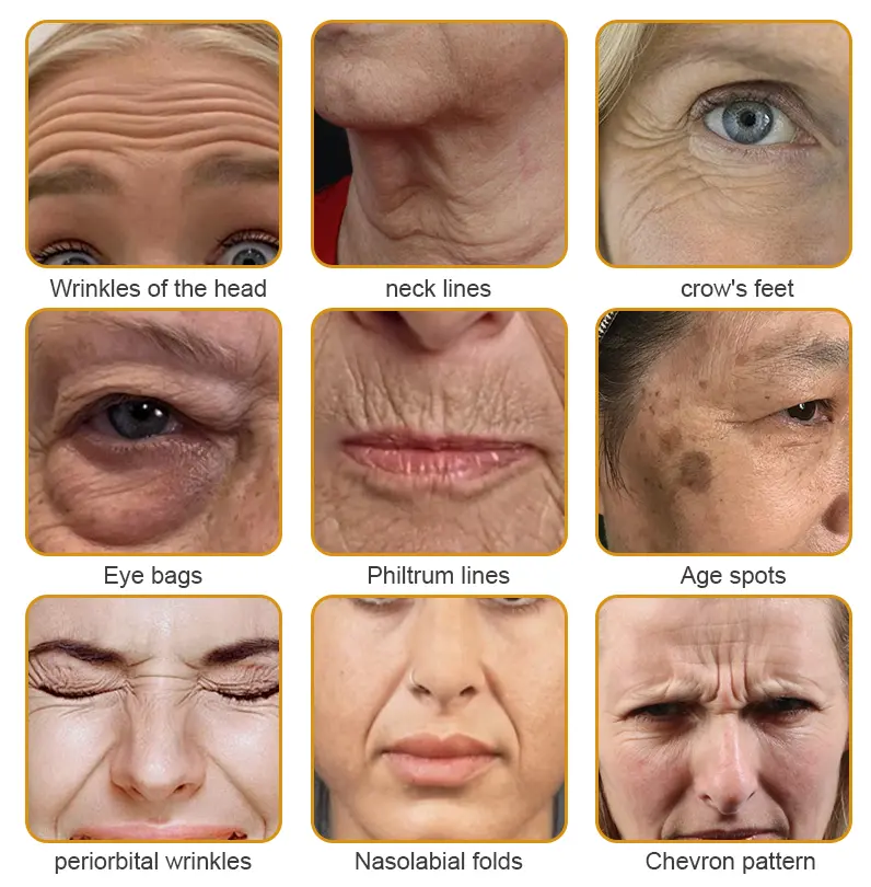 Winter Sale Bee Toxin Wrinkle Removal Cream - Image 3