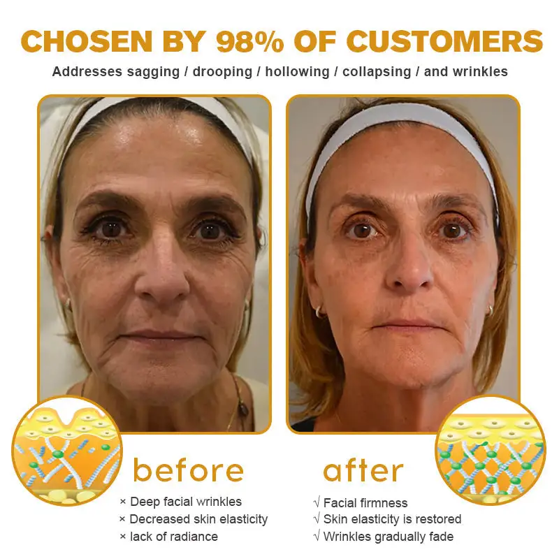 Winter Sale Bee Toxin Wrinkle Removal Cream - Image 8